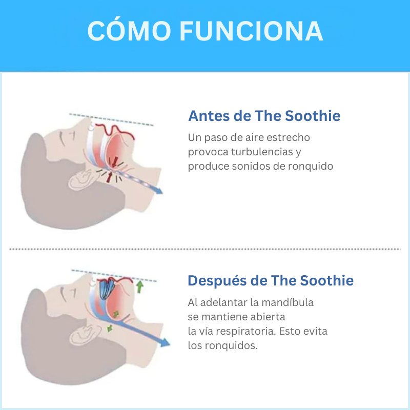 Noctivare Anti-Snoring