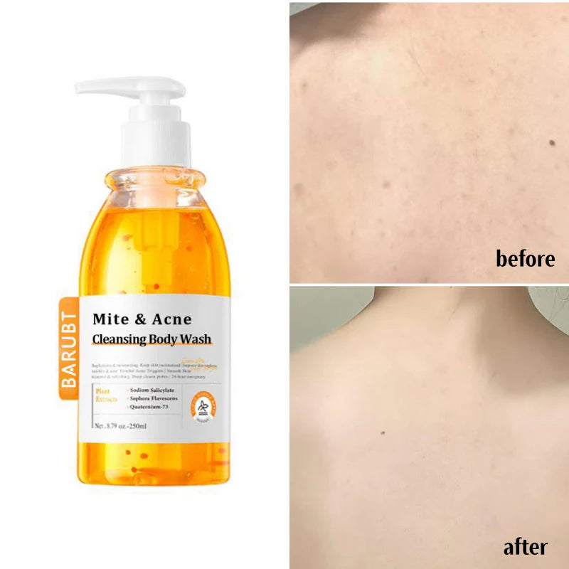 ClearDerm Detox Body Wash