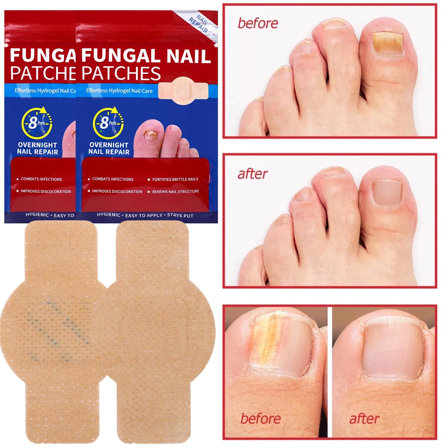 NailHealth