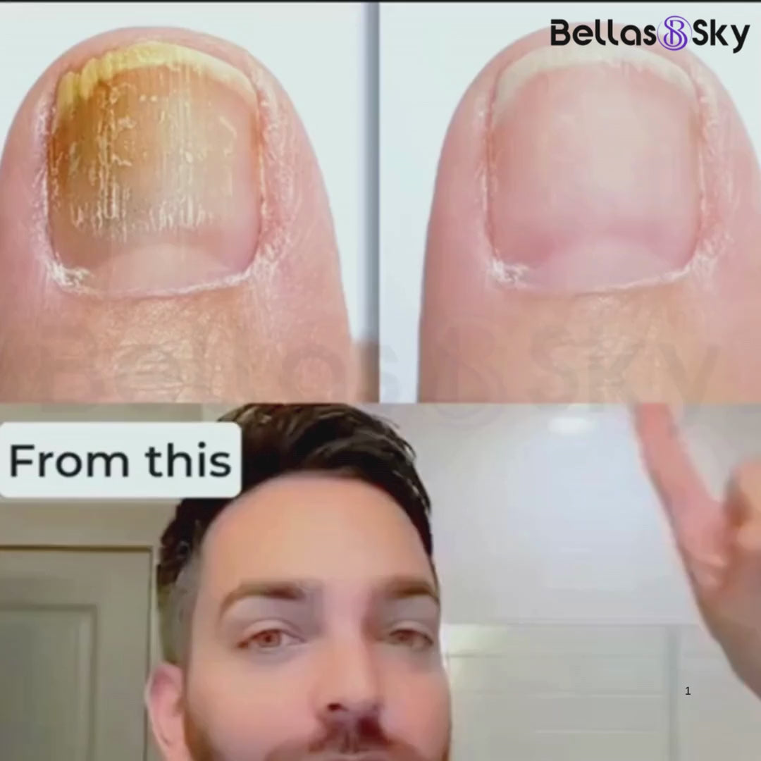 NailHealth